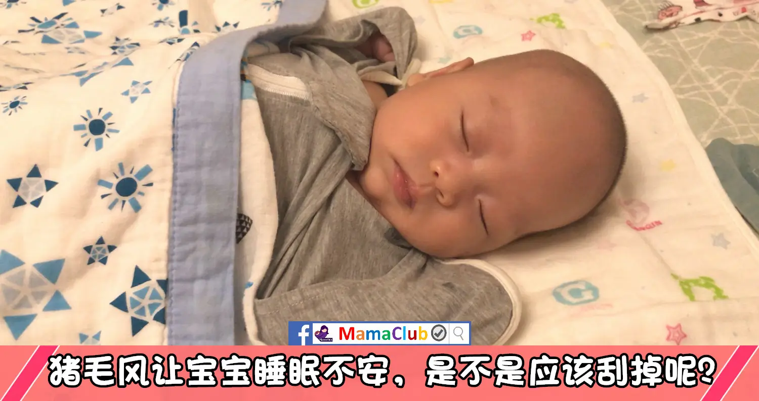 新生护理 猪毛风让宝宝睡眠不安 是不是应该刮掉呢 Mamaclub Mamaclub