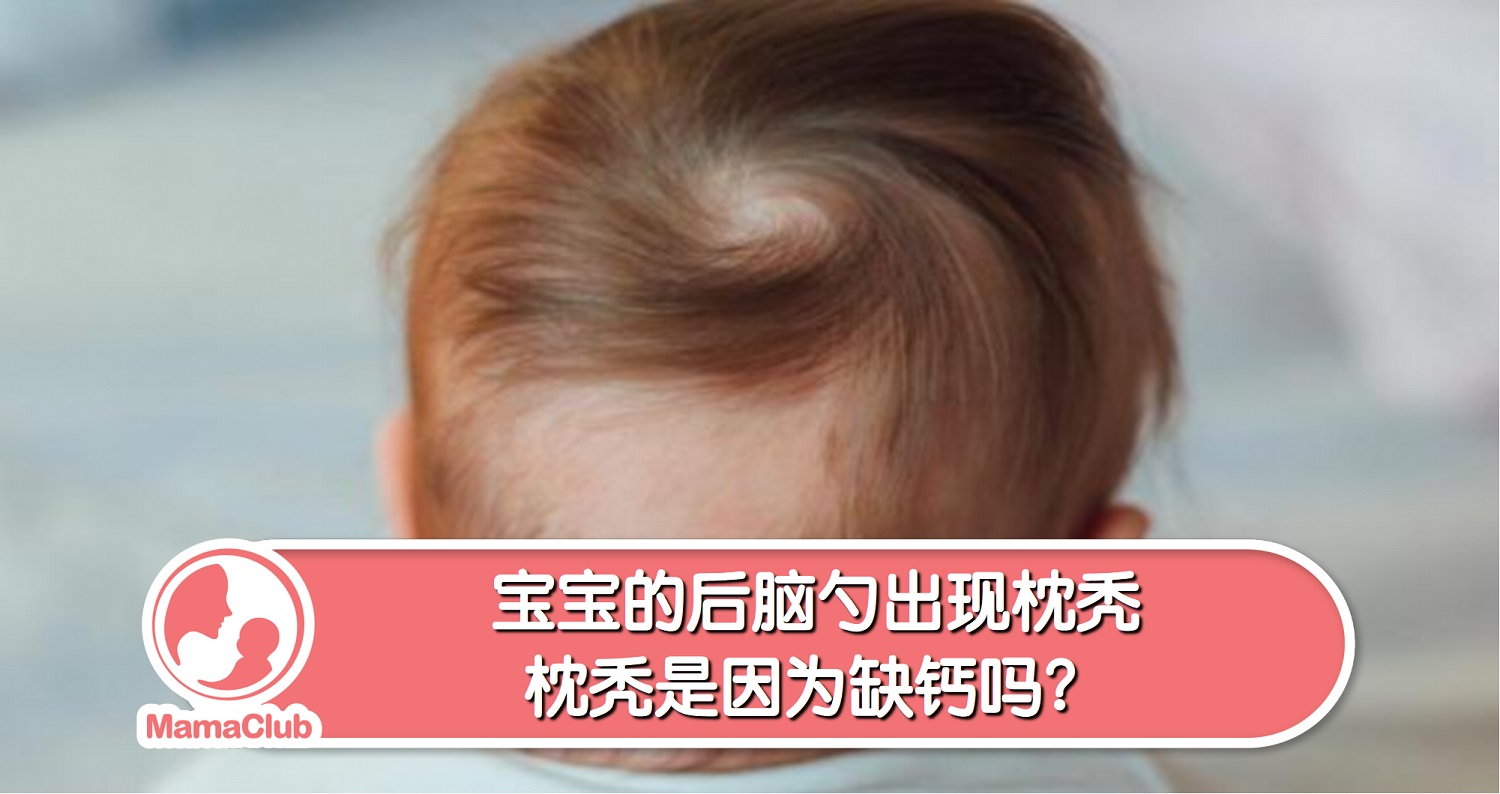 小宝宝的后脑勺为什么会“秃顶”？_斑秃