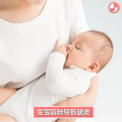 喂母乳