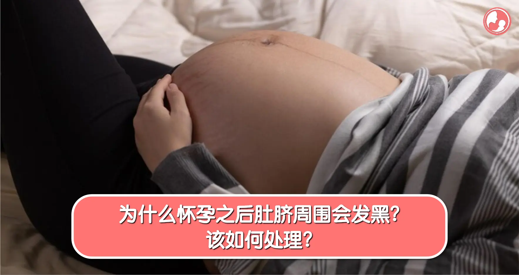 【孕期肚脐】为什么怀孕之后肚脐周围会发黑？该如何处理？